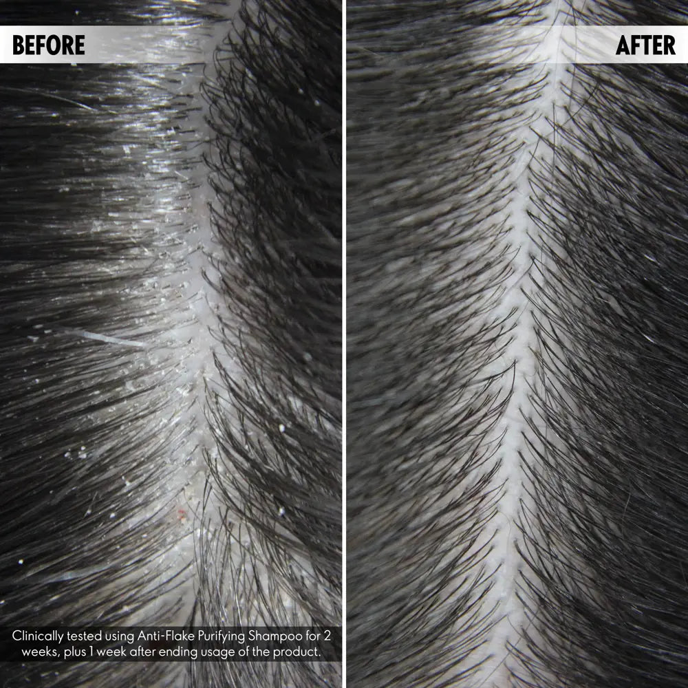 Oriflame Duologi Anti-Flake Purifying Shampoo